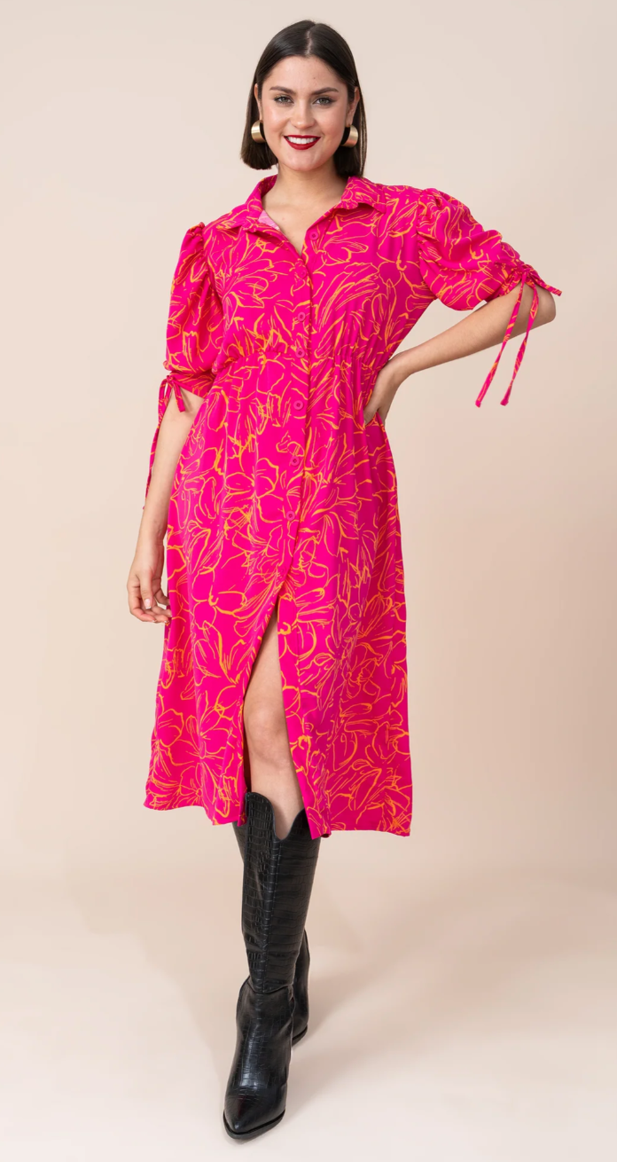 Renueva tu Estilo 5 Vestidos casuales que ser n tendencia esta